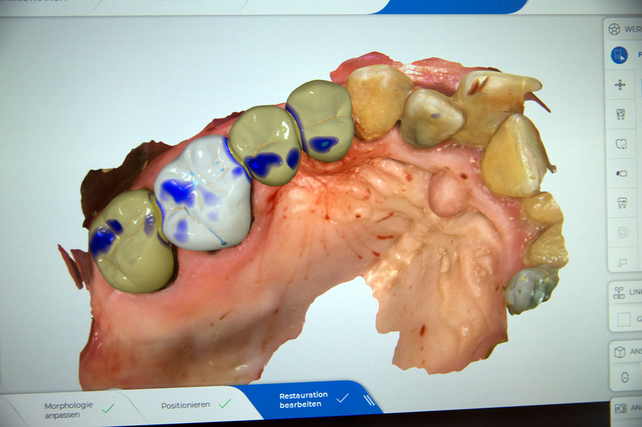 weis-voss-zahnarzt-rendsburg-cerec